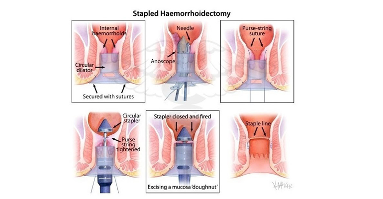 best minimal invasive surgeon in Faridabad